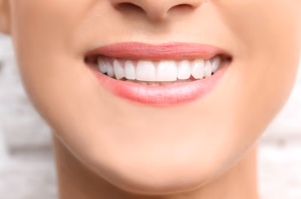 How Long Does Professional Teeth Whitening Take to See Results?