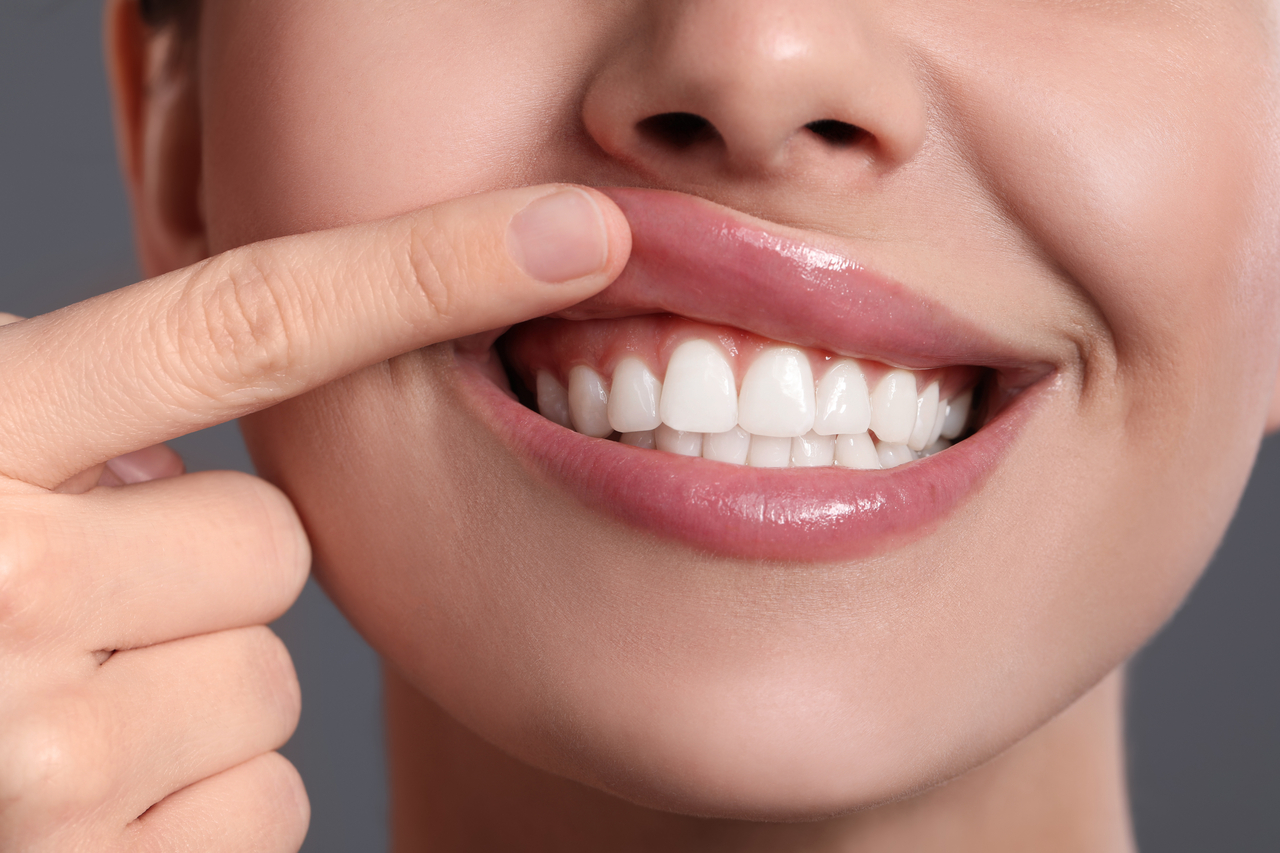 What Is Gum Contouring? Everything You Need to Know