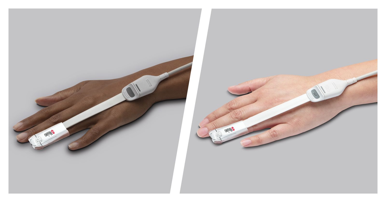 Masimo - New Peer-Reviewed Study Finds That Masimo SET® Pulse Oximetry ...