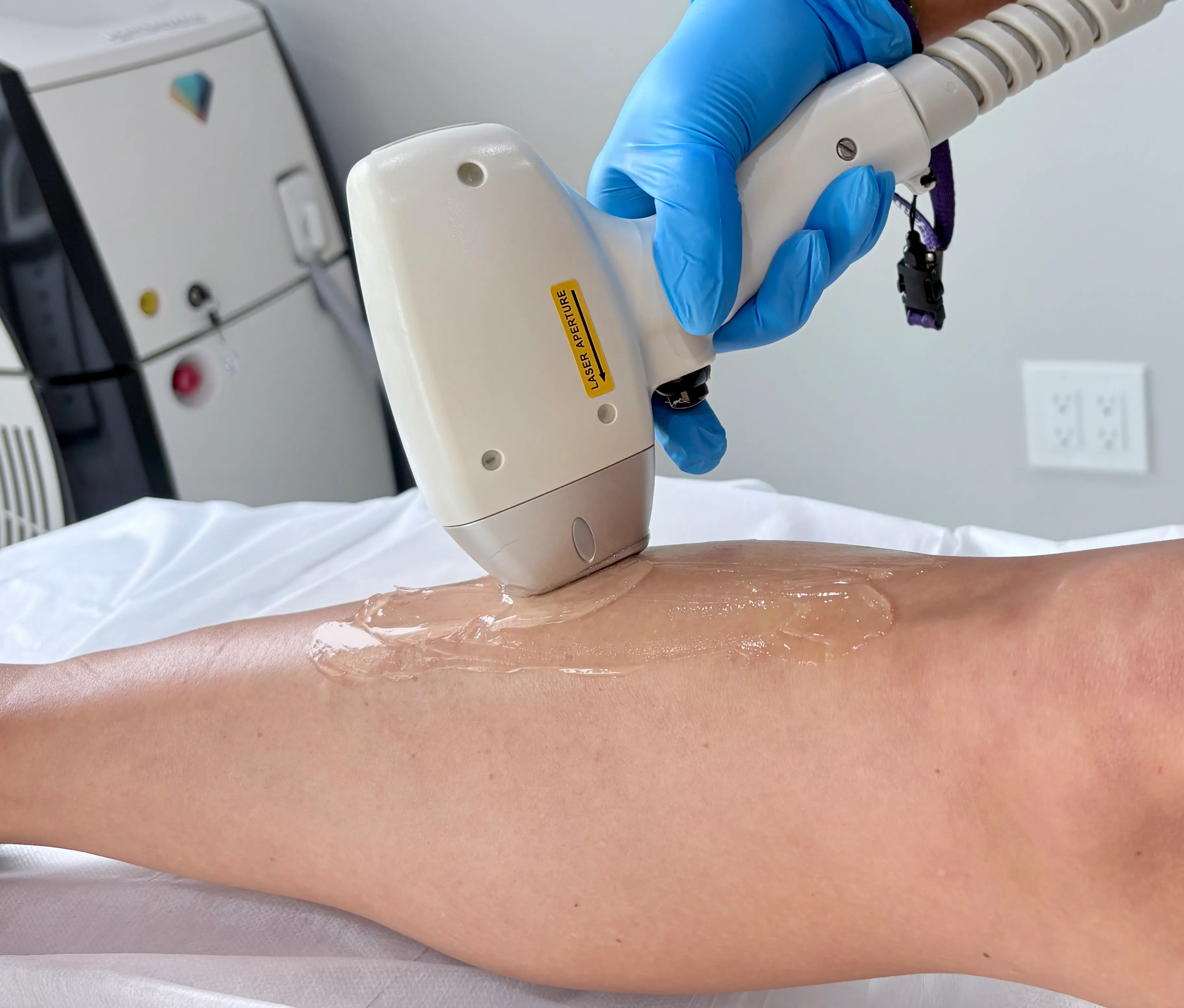 Laser Hair Removal
