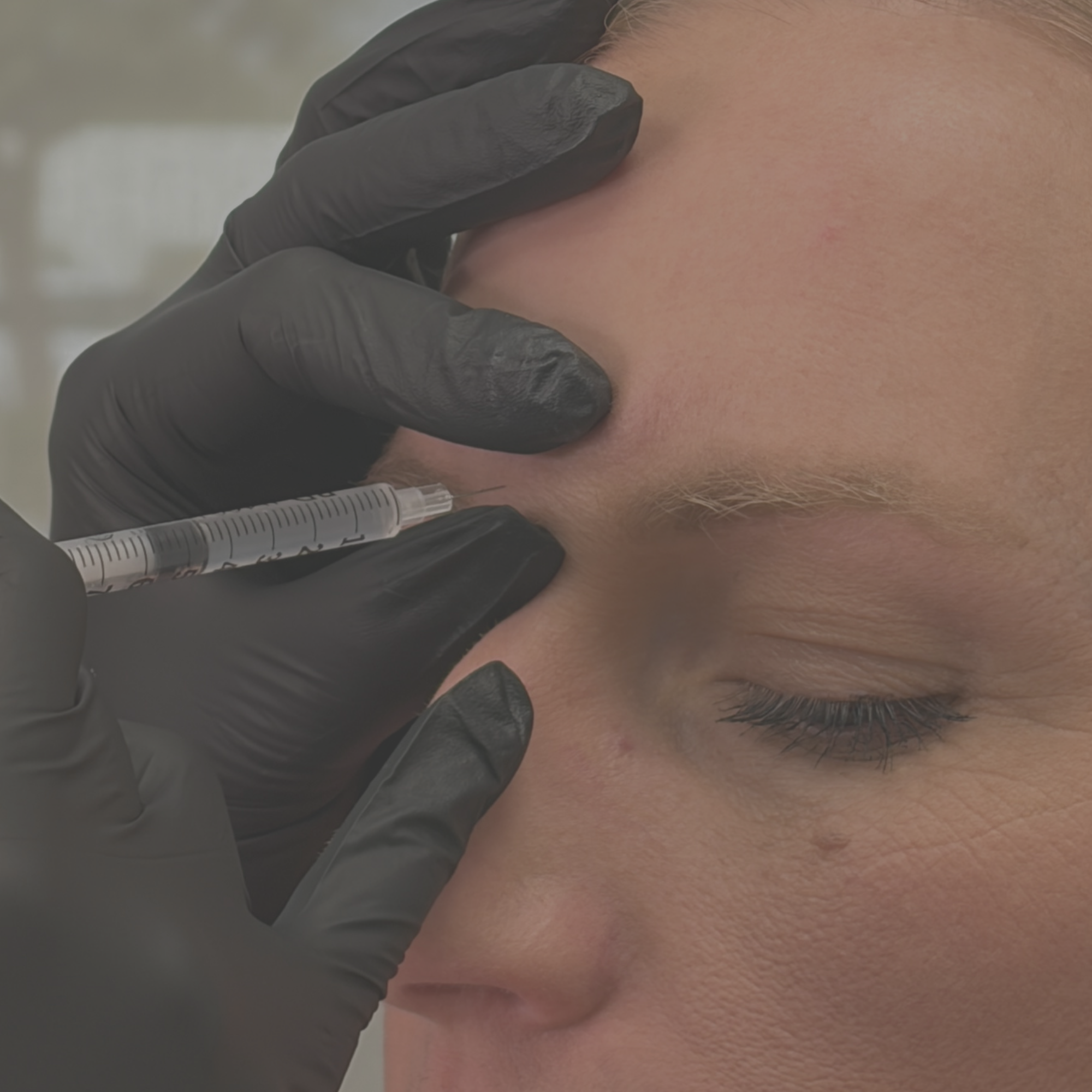 Glabella Botox injection at Biolite Wellness