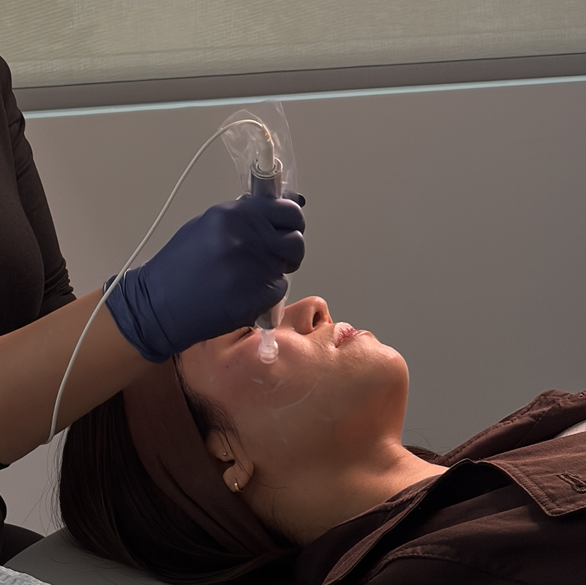 Professional skin treatment at Biolite Wellness