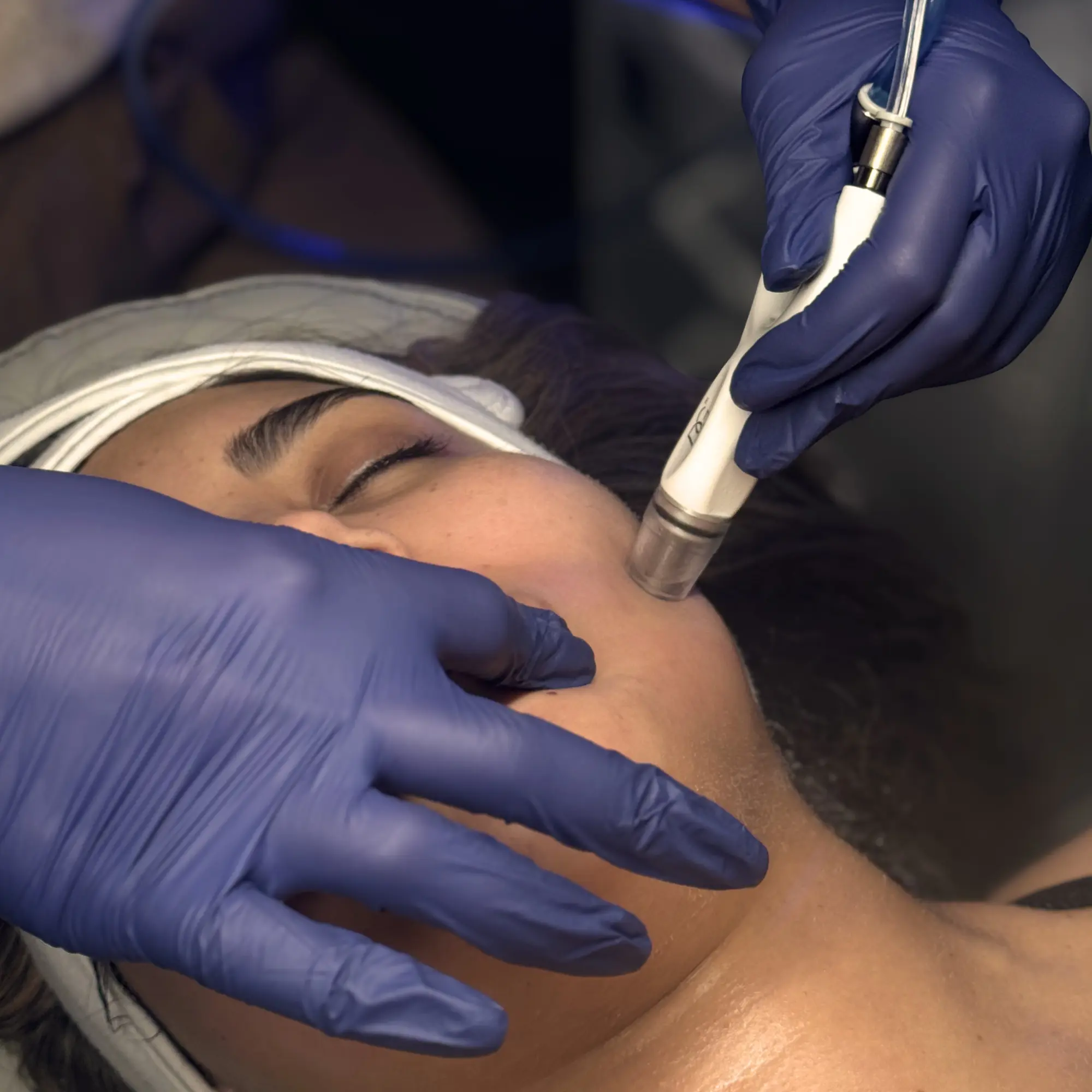 DiamondGlow facial treatment at Biolite Wellness in Irvine, CA