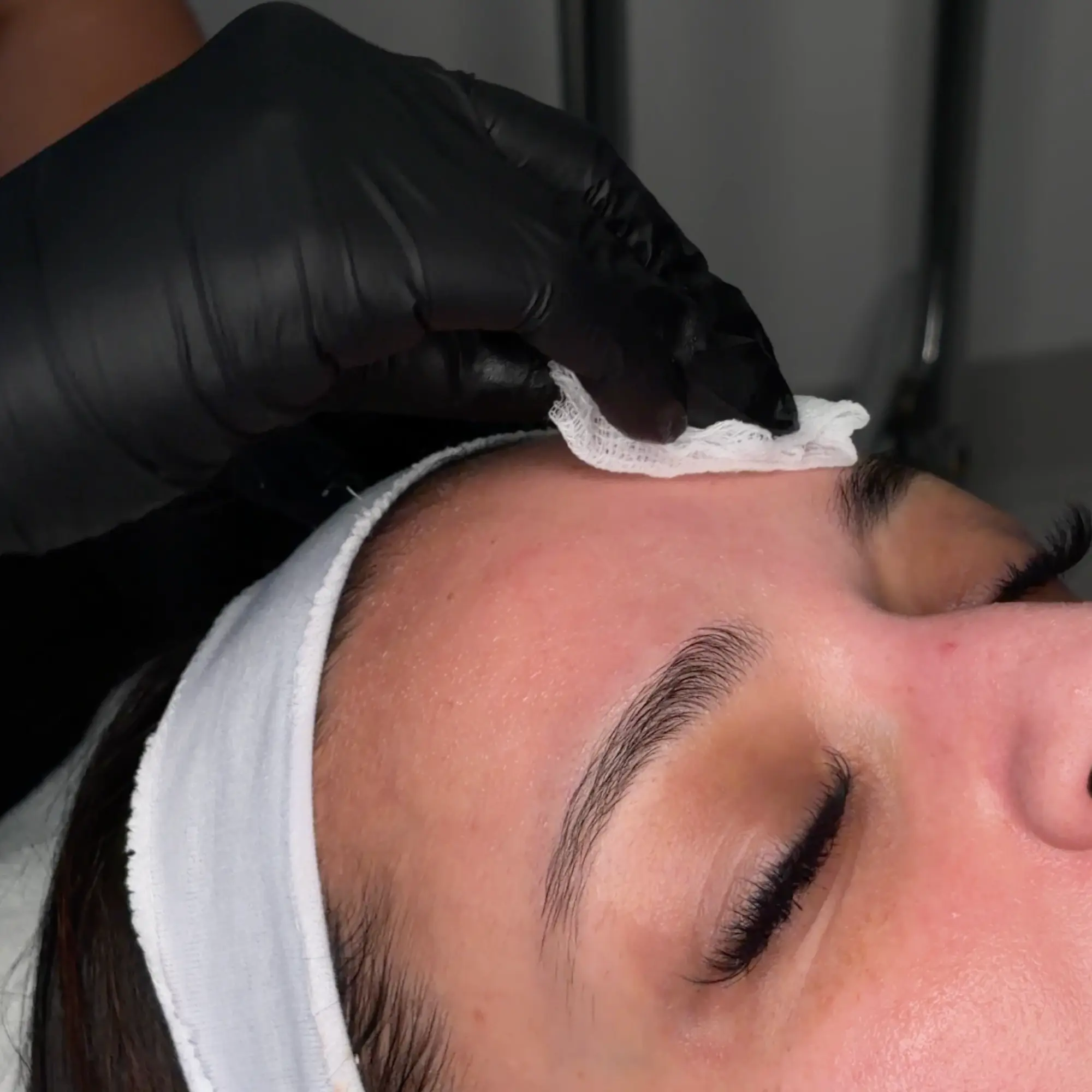SkinCeuticals chemical peel treatment at Biolite Wellness in Irvine, CA