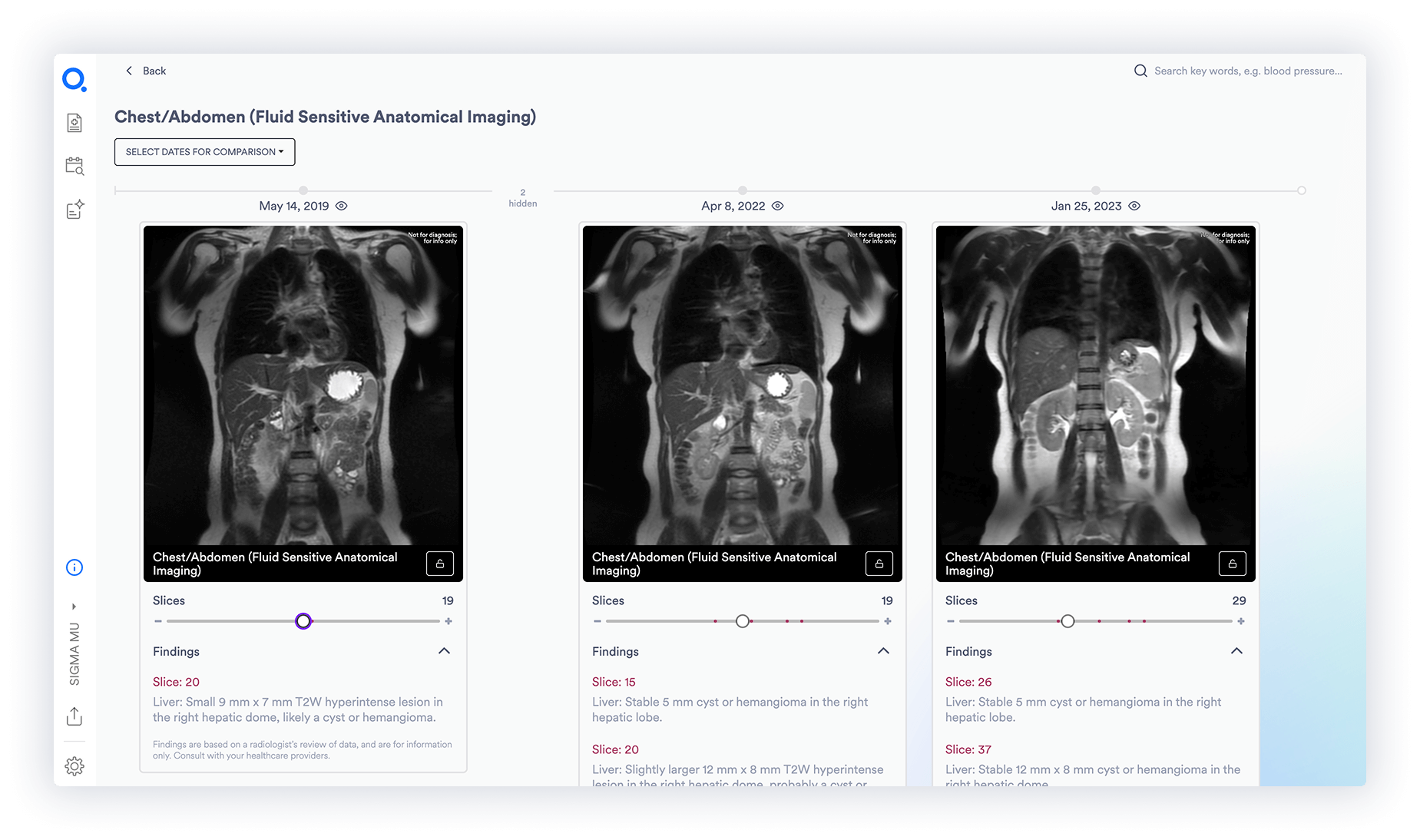 Image Series Comparison