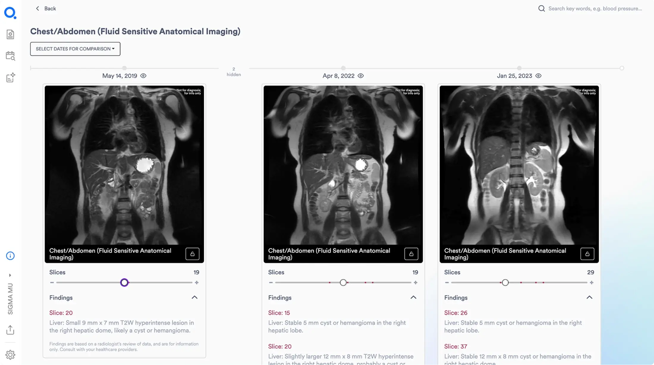 Image Series Comparison