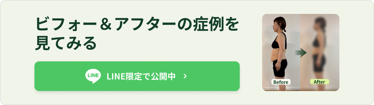 メディカルダイエット ビフォーアフター