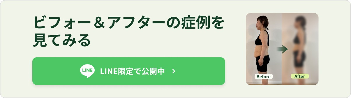 メディカルダイエット ビフォーアフター
