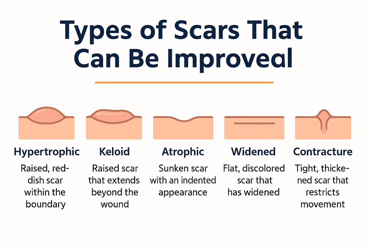 Create a 1536x1024 landscape infographic showing "Types of Scars That Can Be Improved" with five sections arranged horizontally. Each sectio