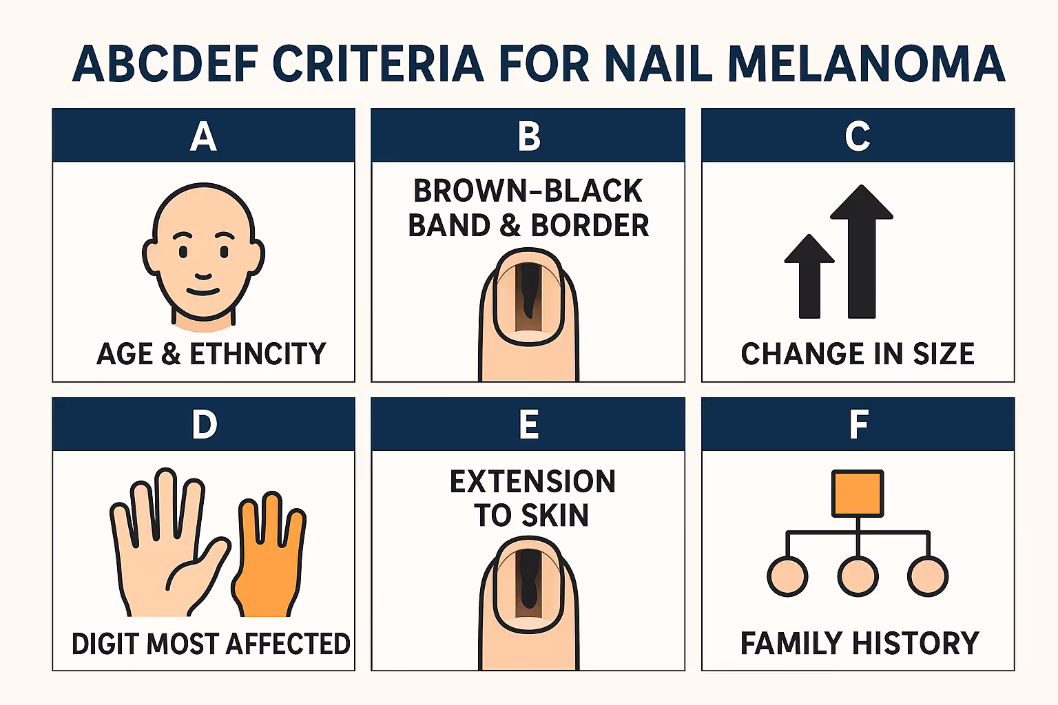 Educational infographic in 1536x1024 landscape format showing the ABCDEF criteria for nail melanoma. Six distinct sections arranged in a gri