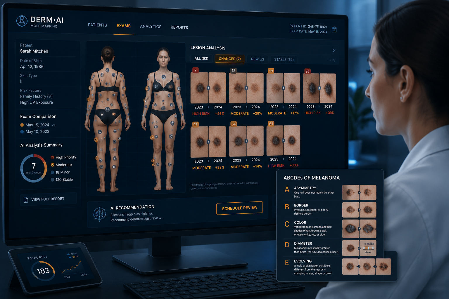 () concept image showing a digital mole mapping workstation: a large monitor displays a full-body photography grid with