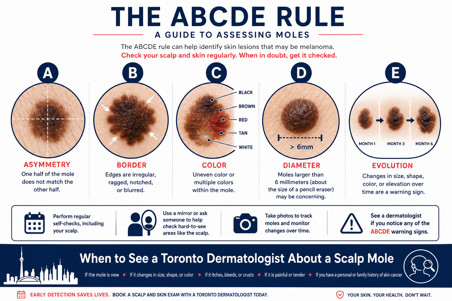 Are Scalp Moles Dangerous or Cancerous?