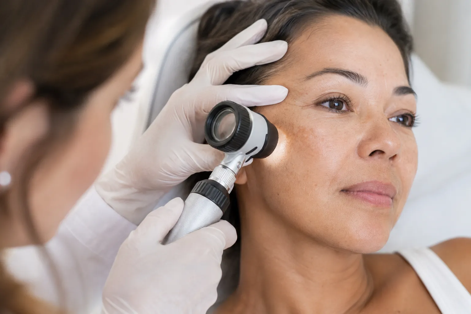 What Is the Best Way to Remove a Mole From Your Face