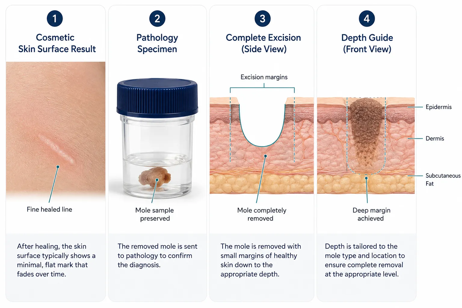 What "Mole Removal Results" Actually Means