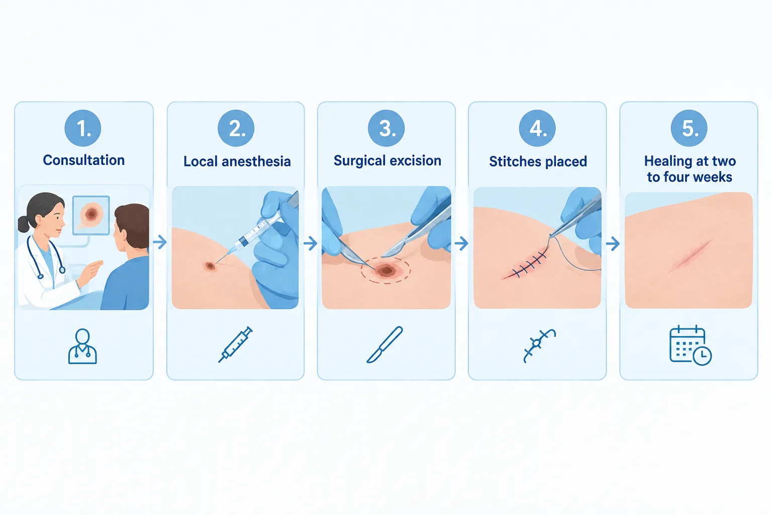 Can Your Family Doctor Remove Skin Cancer, or Do You Need a Specialist?