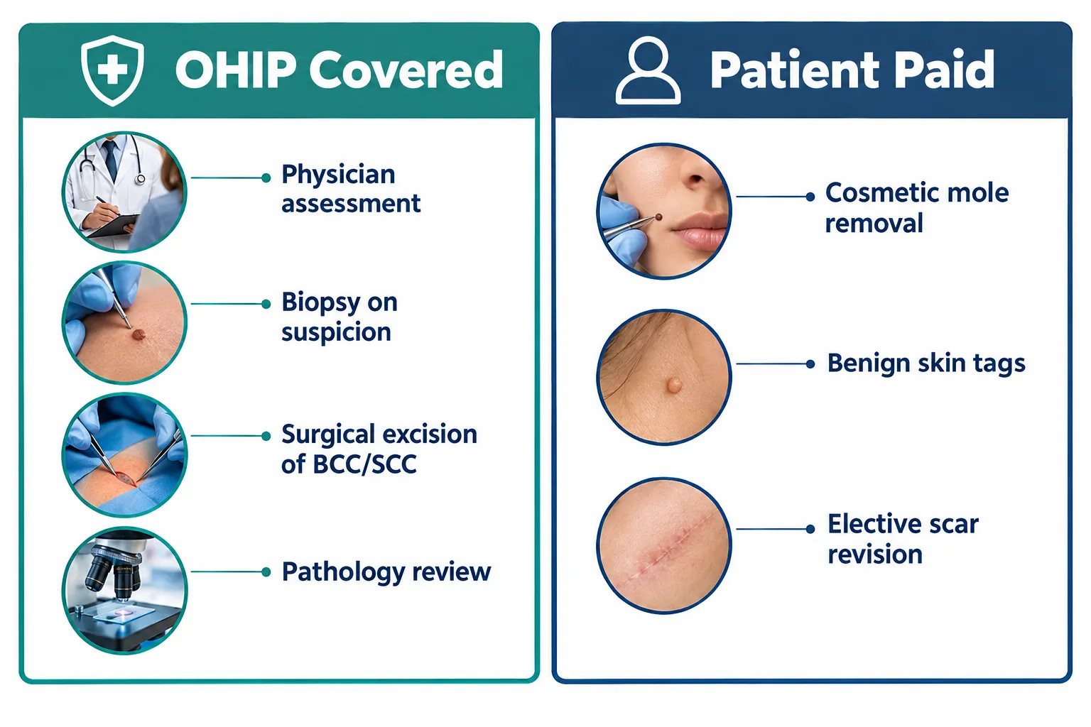 Skin Cancer (BCC/SCC) Removal Cost in Ontario: What OHIP Covers