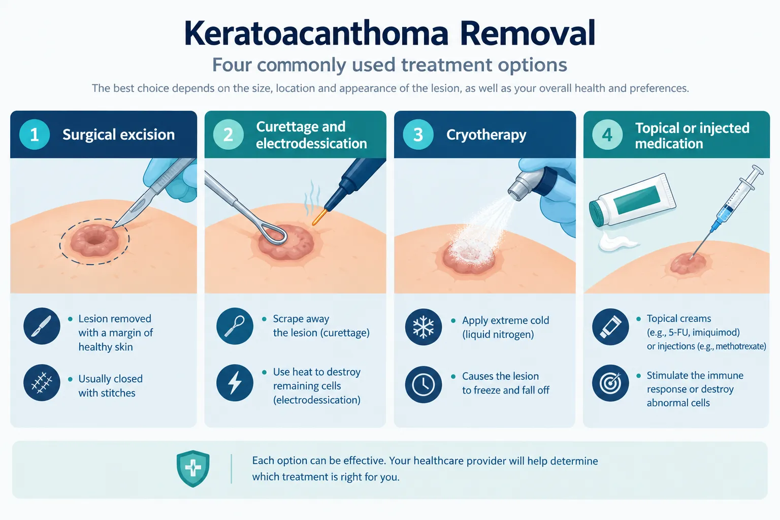 Keratoacanthoma Recurrence: Can You Get It More Than Once