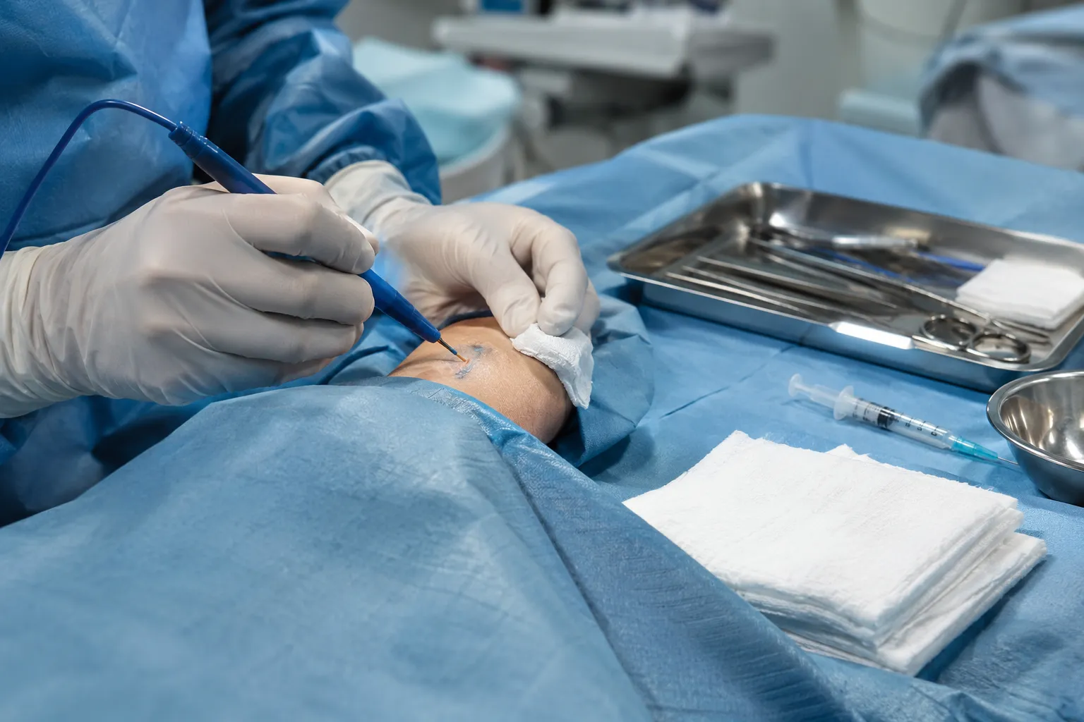 Warfarin vs apixaban, rivaroxaban and dabigatran: how does preparation differ?