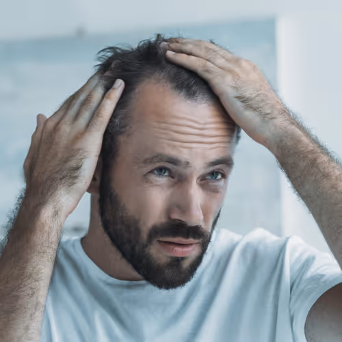 Hair Loss (Alopecia) Treatment