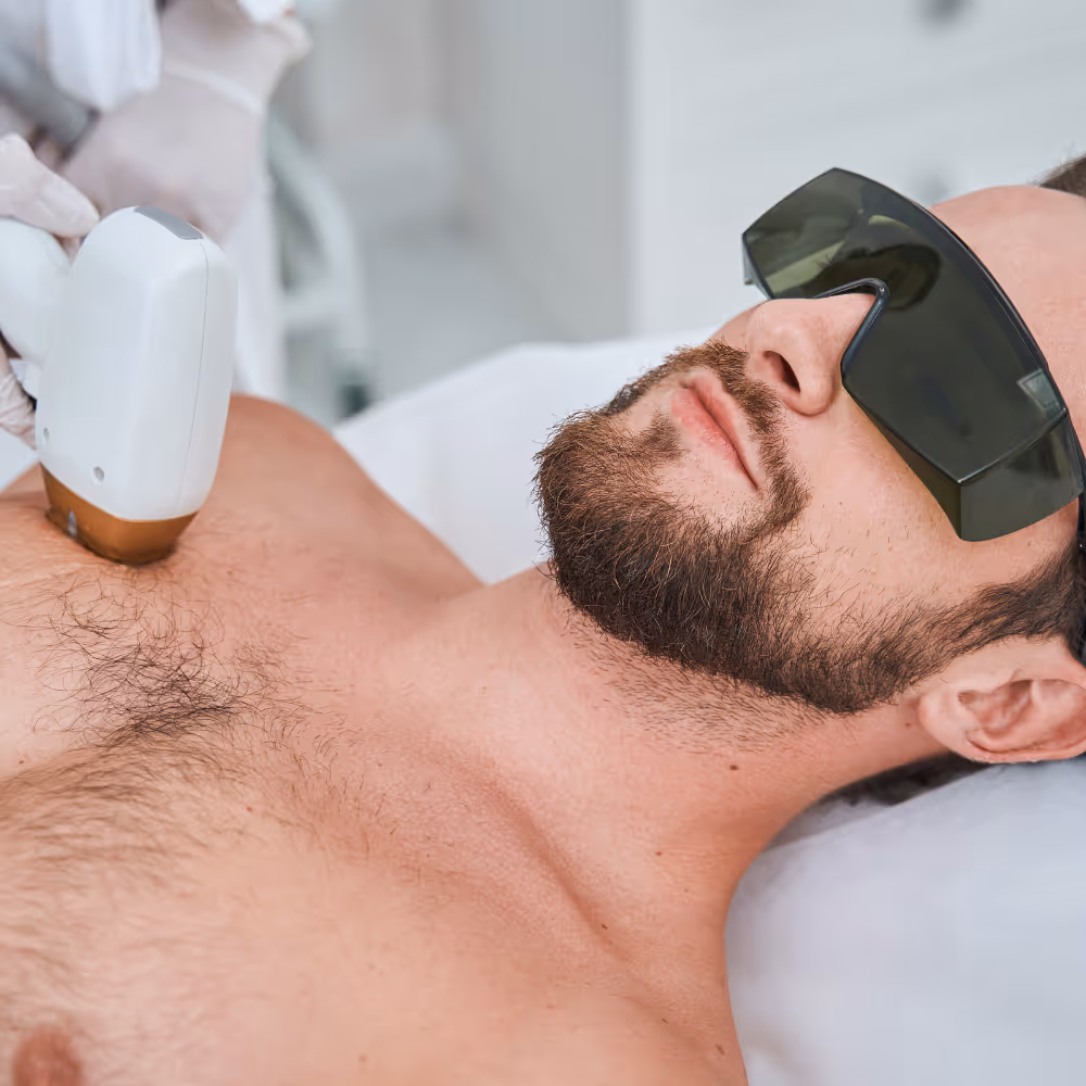 Laser ontharen voor mannen