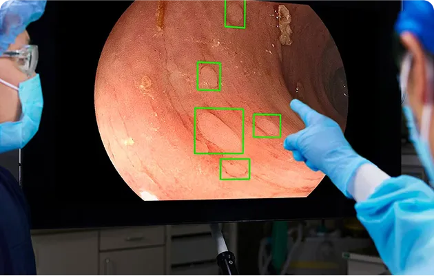 Two medical professionals in masks and gloves examining a colonoscopy image with highlighted areas on a monitor.
