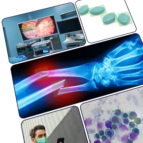 Collage of medical-related images including a surgical operation shown on a monitor, blue pills with dosage text, an X-ray of a fractured forearm with highlighted injury, a man wearing a mask looking at his phone, and a microscopic view of cells.