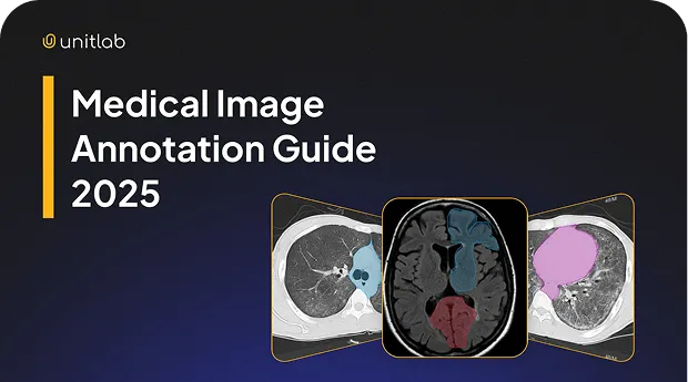 Unitlab AI blog post thumbnail