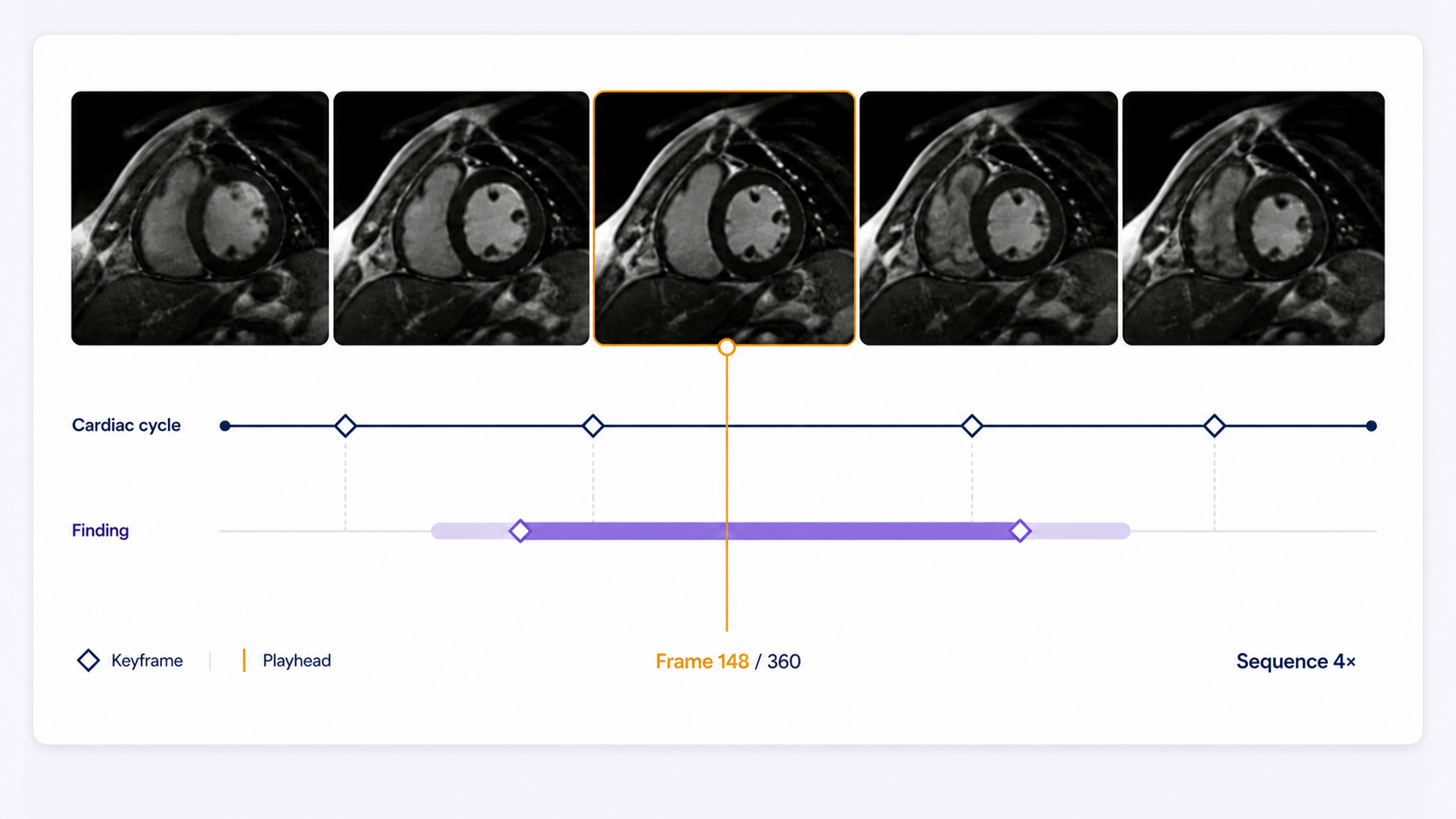 Four video moments connected to object tracks, states, keyframes, and a shared playhead