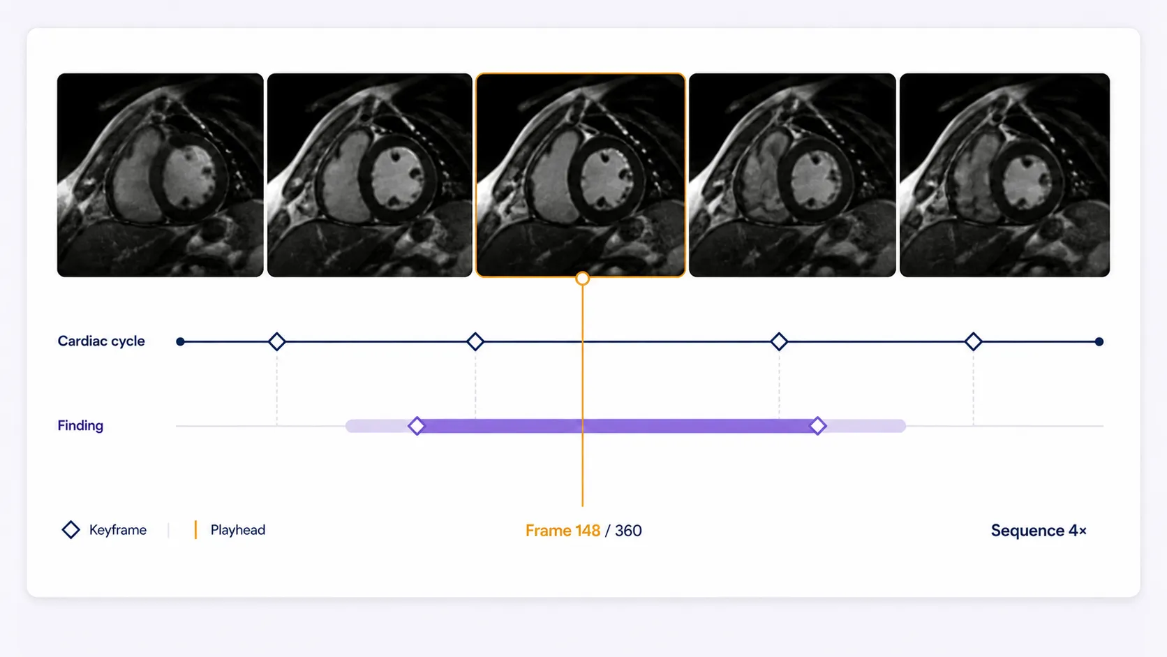 Medical sequence frames connected to synchronized findings, slice states, keyframes, and a shared playhead