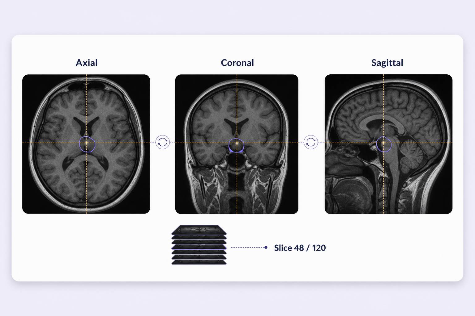 Multiplanar medical annotation with synchronized slice position and geometry