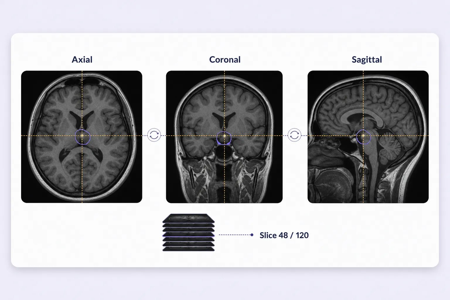 Multiplanar medical annotation with synchronized slice position and geometry