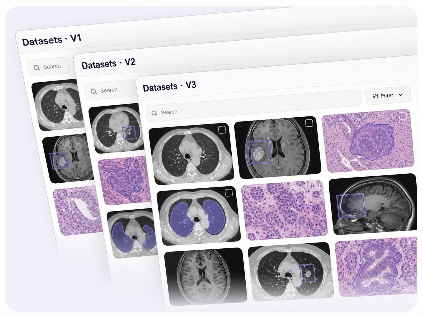 Dataset versions Dataset version control in Unitlab AI for governed medical data releases