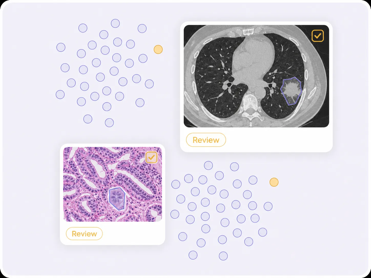 Embedding view use case Dataset embedding visualization with similar medical and pathology cases and review outliers