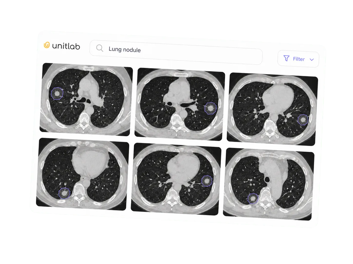 Semantic search use case Semantic search returning matching medical imaging cases in Unitlab AI