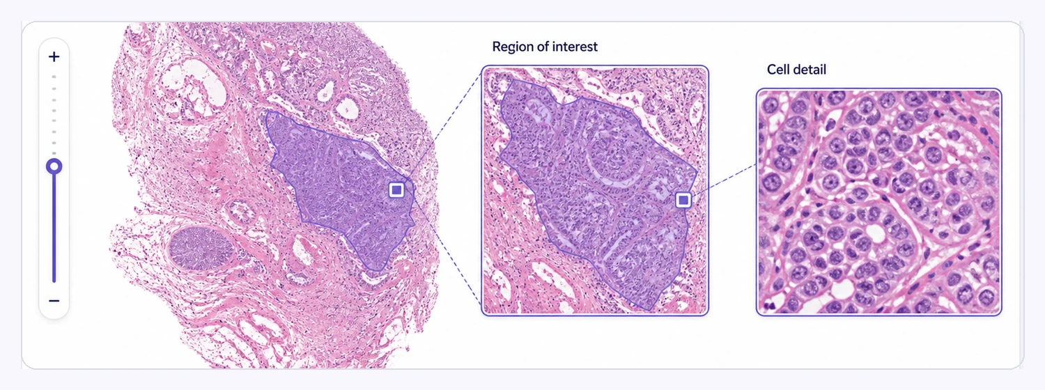 Whole-Slide Image Support Whole-slide pathology view with a focused region of interest and cellular-detail inset.