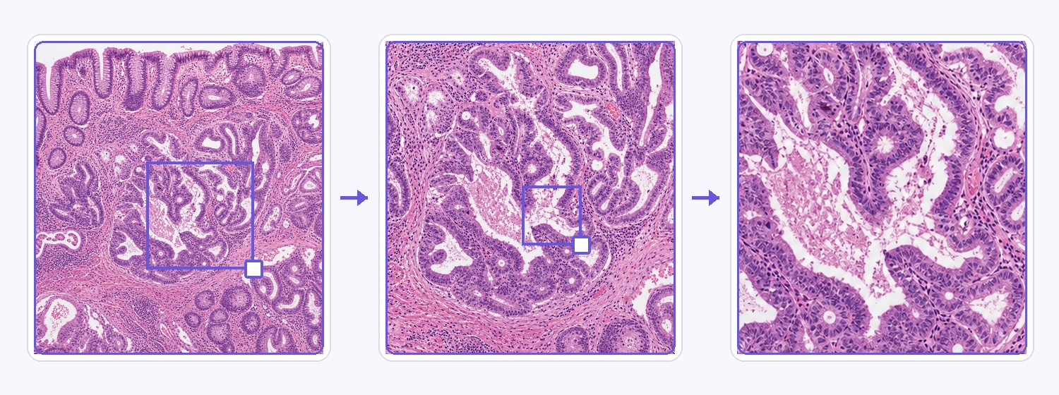 Deep Zoom and Multi-Resolution Viewing One synthetic pathology specimen shown at overview, region, and cellular-detail resolutions.