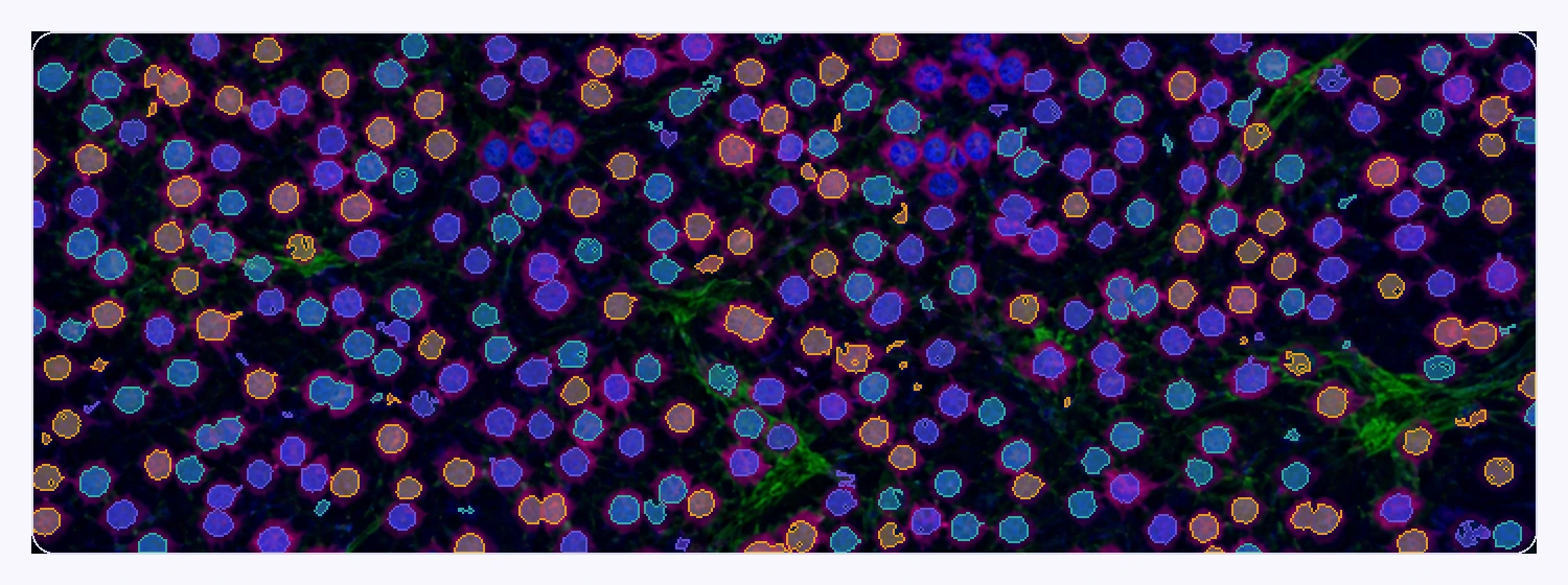 Annotation at Scale Dense synthetic fluorescence pathology field with hundreds of structure-aligned instance segmentation masks.