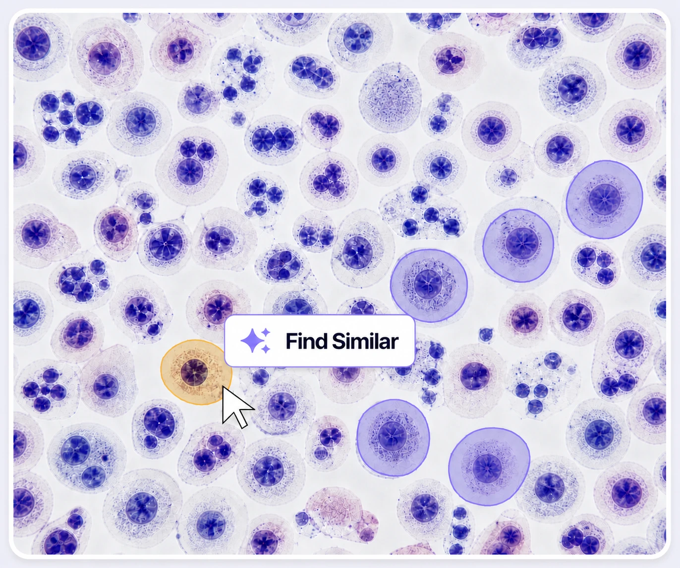 AI-Assisted Auto-Labeling Synthetic pathology cells with exact matching masks, a magic cursor, and a prominent Find Similar action.