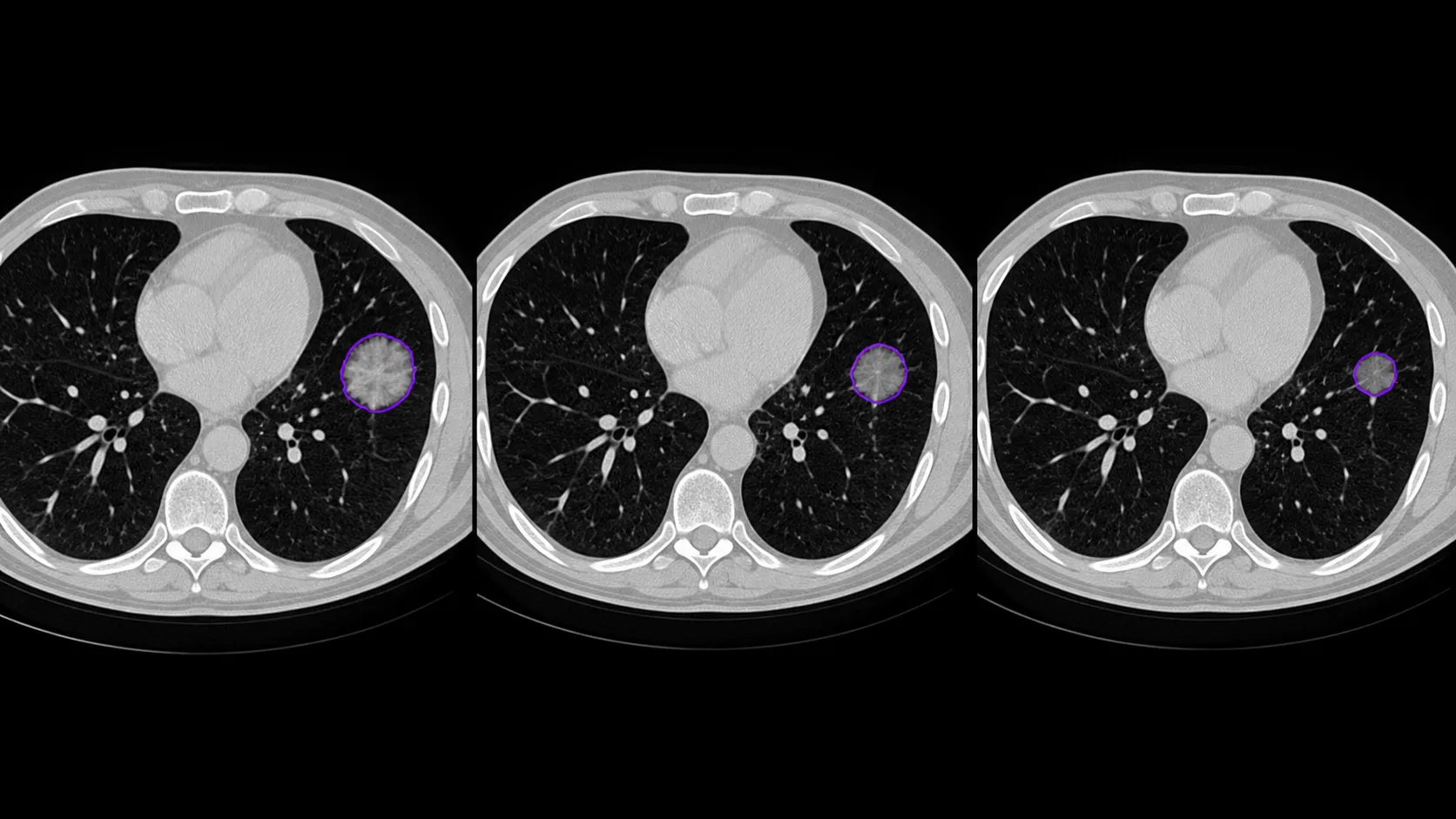 Medical imaging sequences connected across studies for longitudinal analysis.