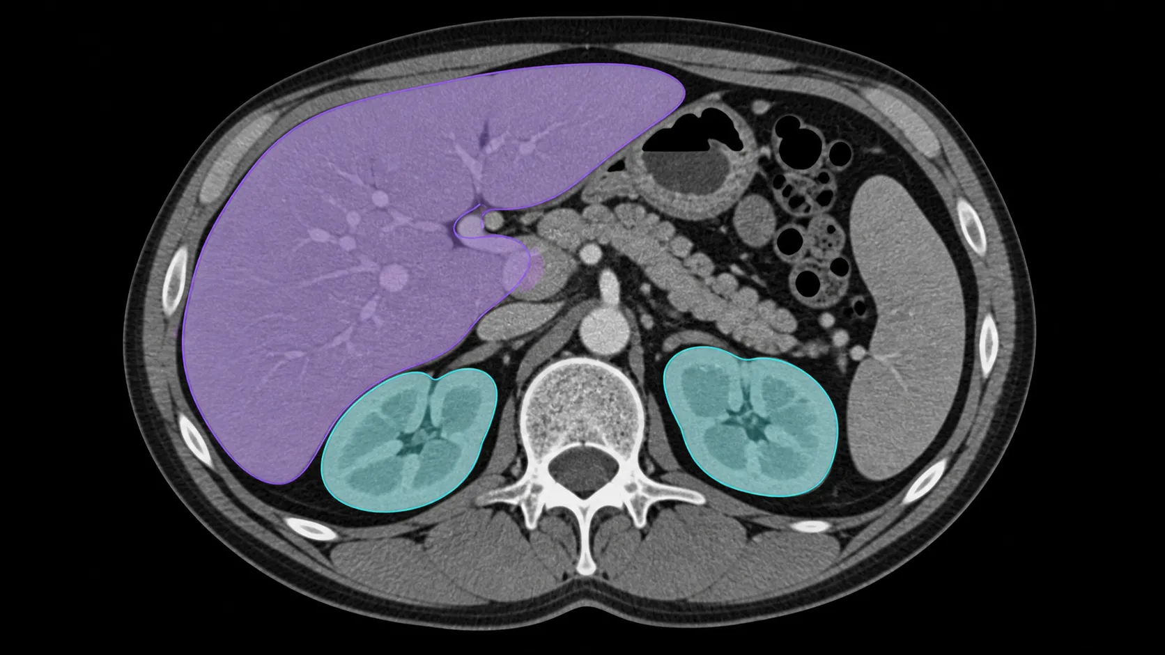 Multiplanar anatomy views with synchronized organ and tissue annotations.