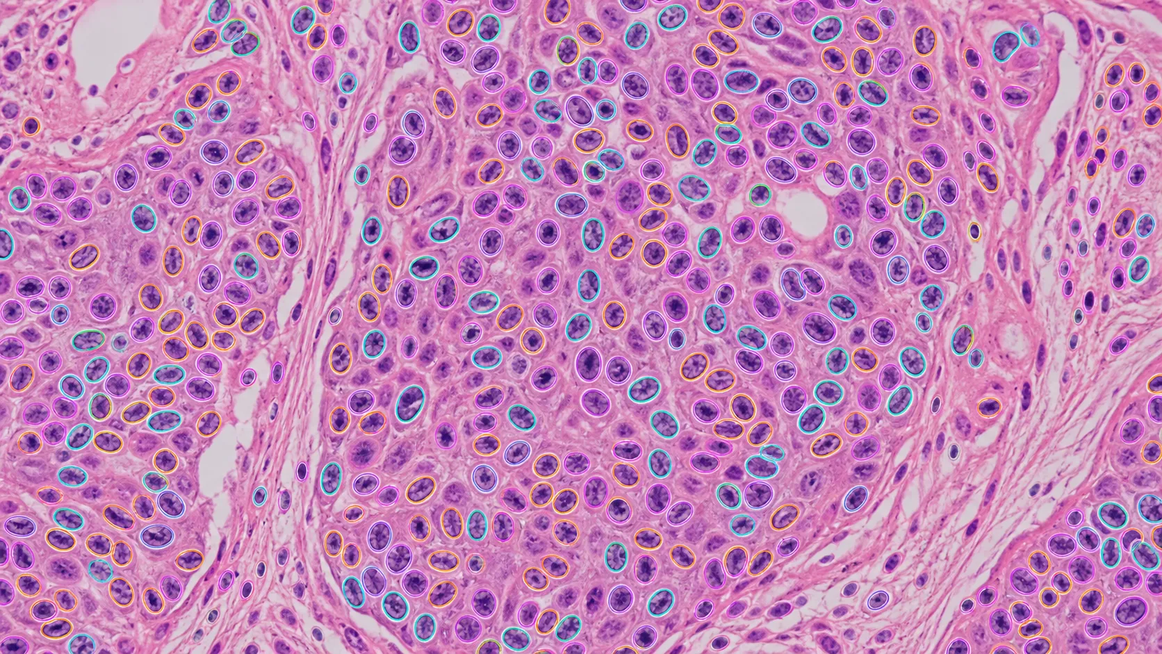 Pathology cells and nuclei with structure-aligned instance segmentation masks.