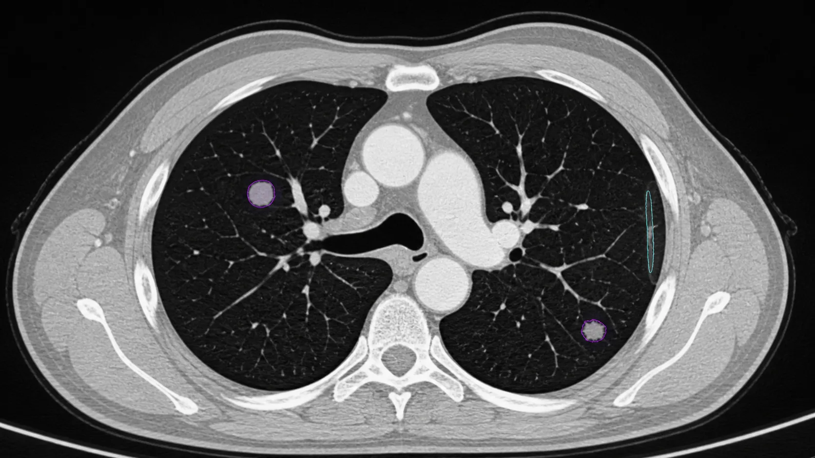 Synchronized medical imaging views prepared for radiology AI annotation.