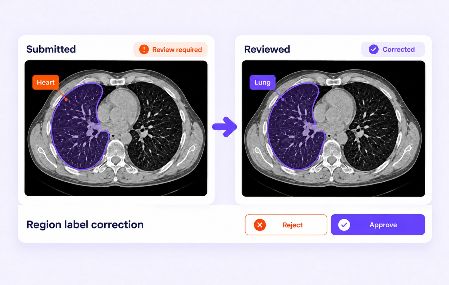 An incorrectly assigned region class is corrected from Heart to Lung on the same annotated CT slice. An incorrectly assigned region class is corrected from Heart to Lung on the same annotated CT slice.