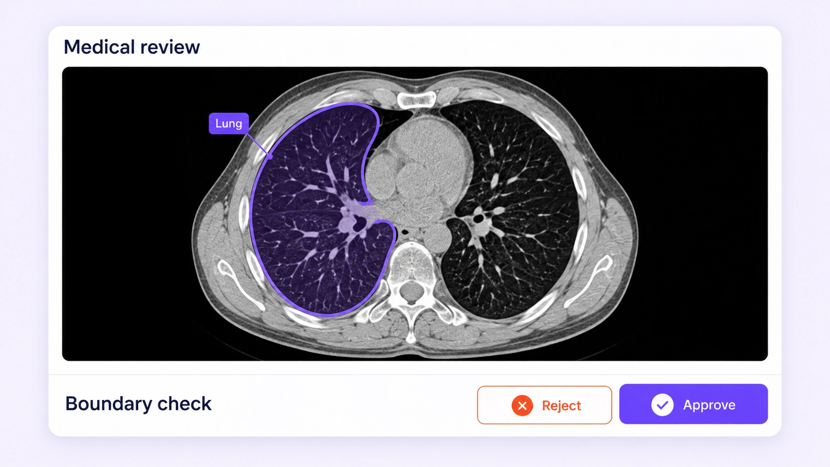 A medical image reviewer checks a lung contour on an axial chest CT slice.