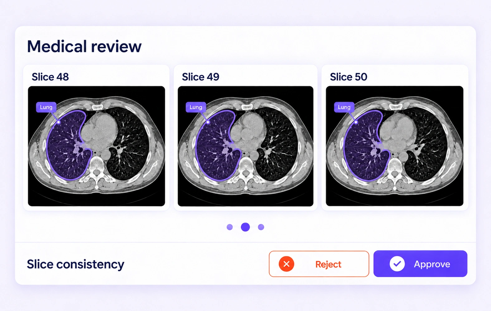 Adjacent CT slices show coherent contours for the same lung region during volume review. Adjacent CT slices show coherent contours for the same lung region during volume review.
