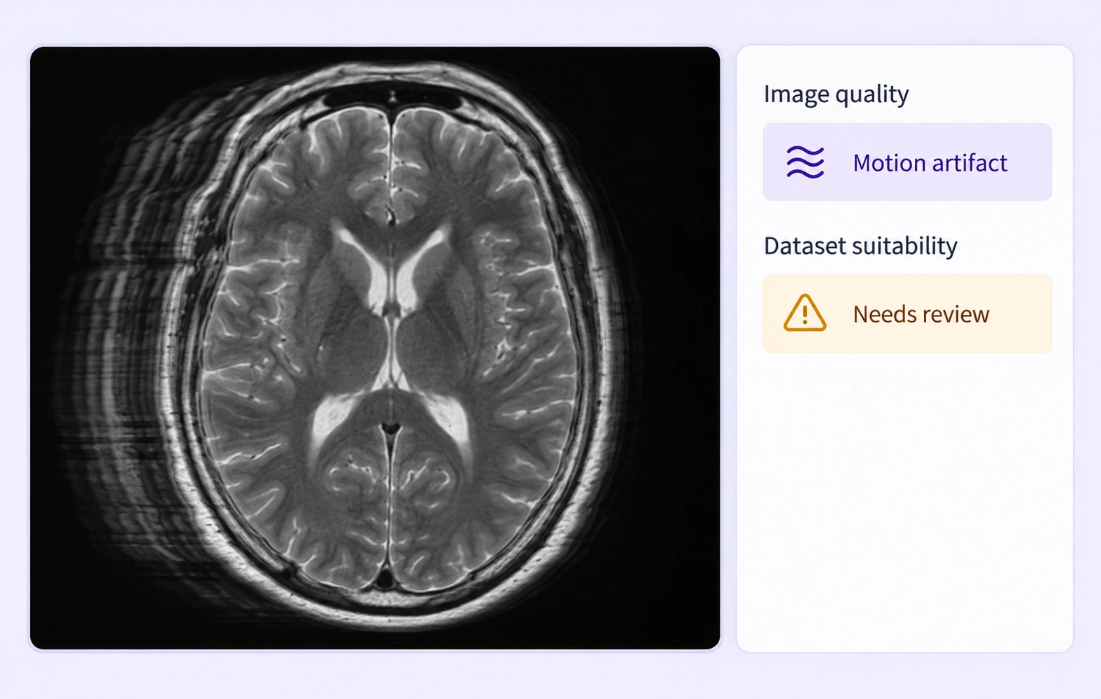 MRI example with expert-defined motion-artifact and review labels.
