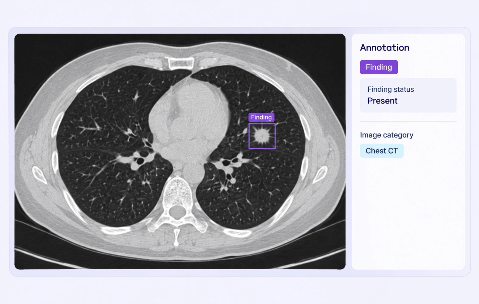Medical image with a finding region and its supporting item classification.