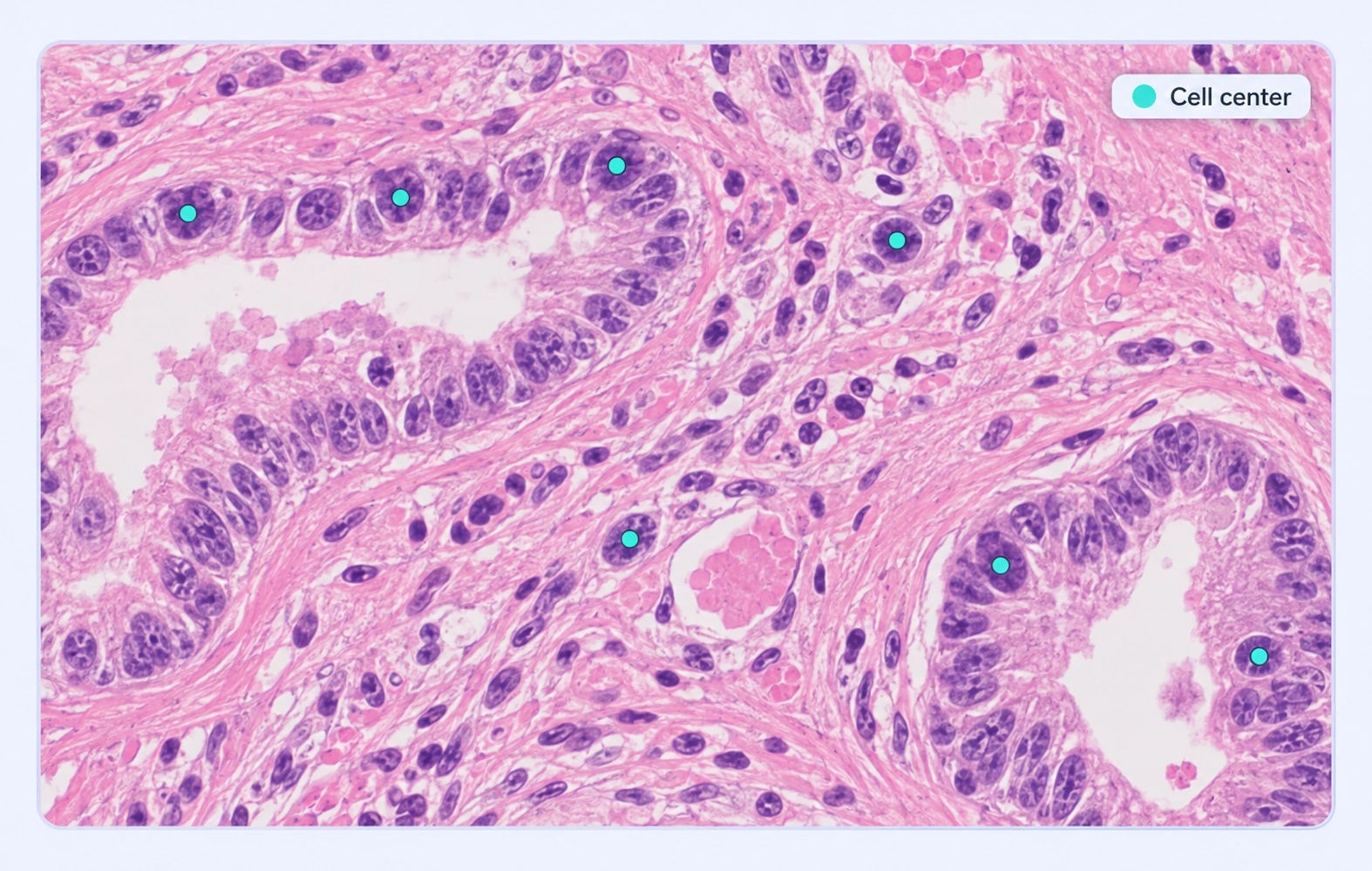 Histology with point annotations marking cell centers. Histology with point annotations marking cell centers.