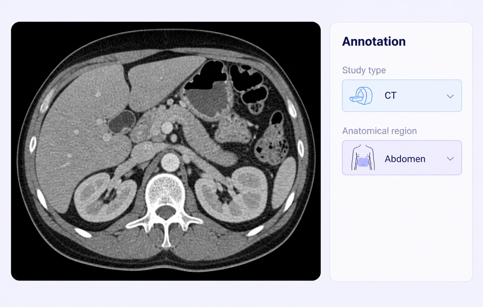 Abdominal CT with study-type and anatomical-region item labels.