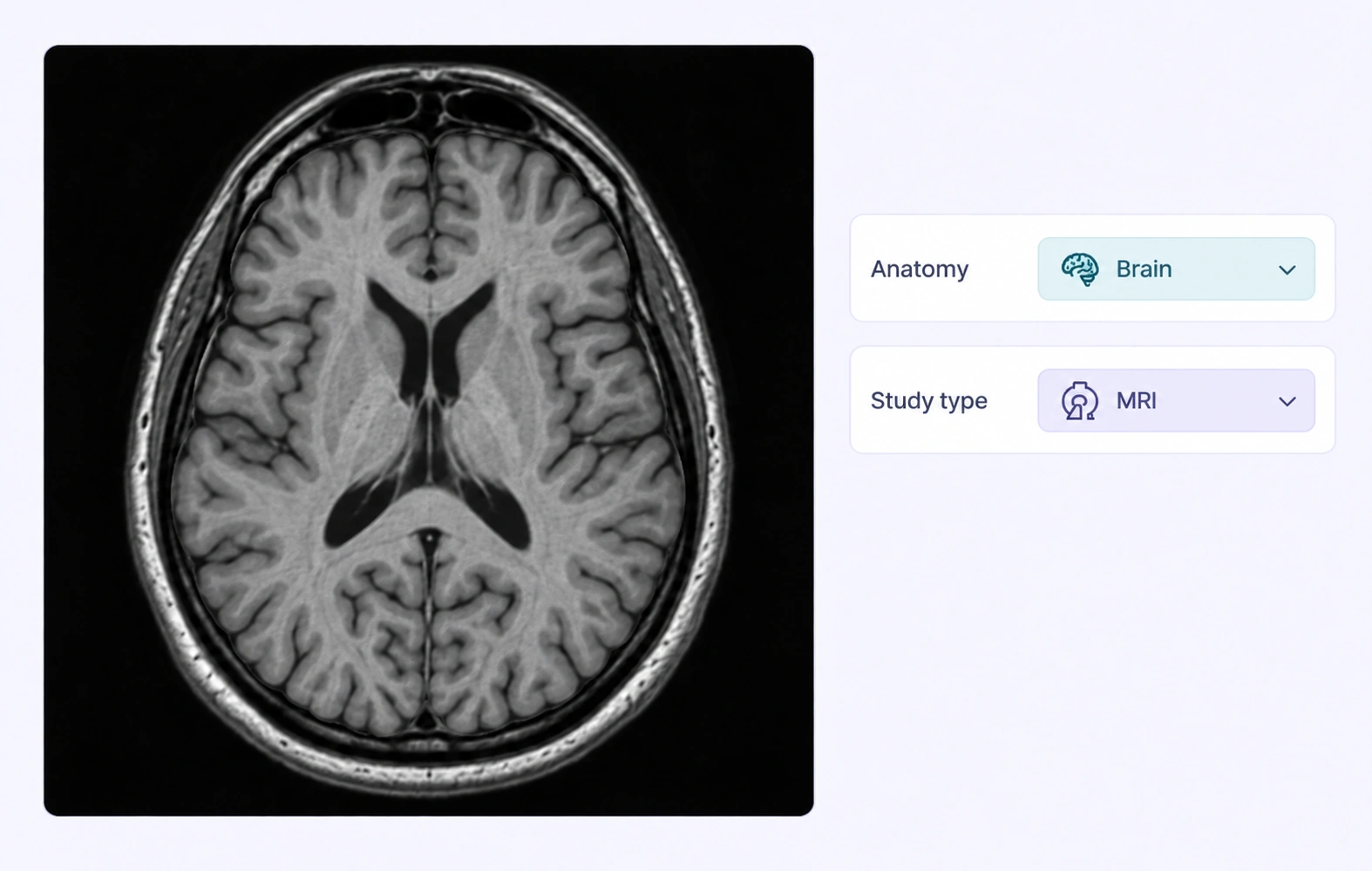 Brain MRI assigned whole-image anatomy and study-type categories.
